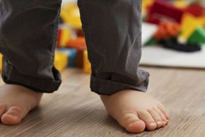 Плоскостопість у дитини &ndash; що робити? фото